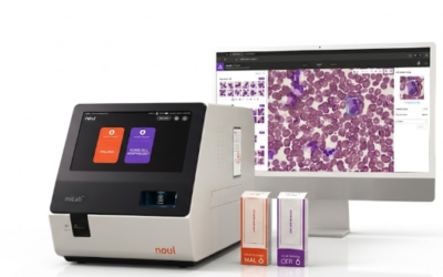 Intelligenza Artificiale e microscopia digitale in Ematologia: le decisioni cliniche non aspettano